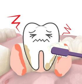 무심코 넘긴 치약 거품 속 &lsquo;피&rsquo; 치아 뽑게되는 &lsquo;치주 질환&rsquo; 의심 신호
